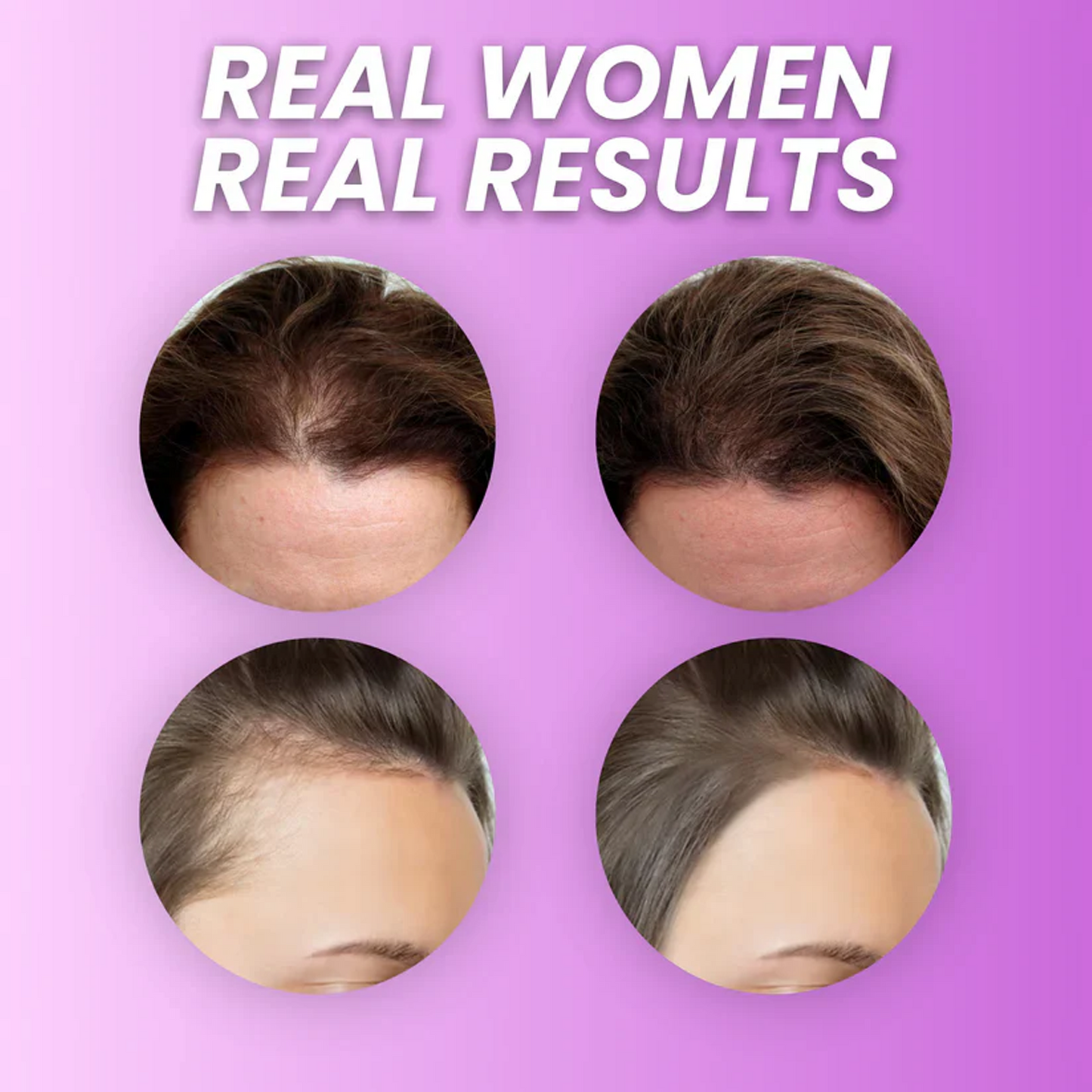 Treniwus™ Hair Growth Accelerator Soft Chews