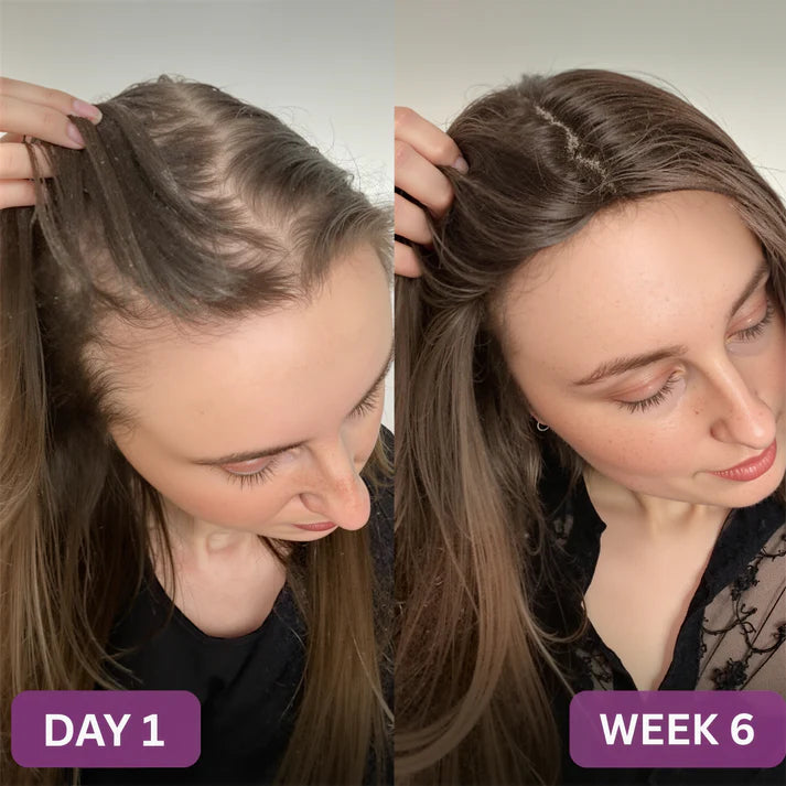 Treniwus™ Hair Growth Accelerator Soft Chews