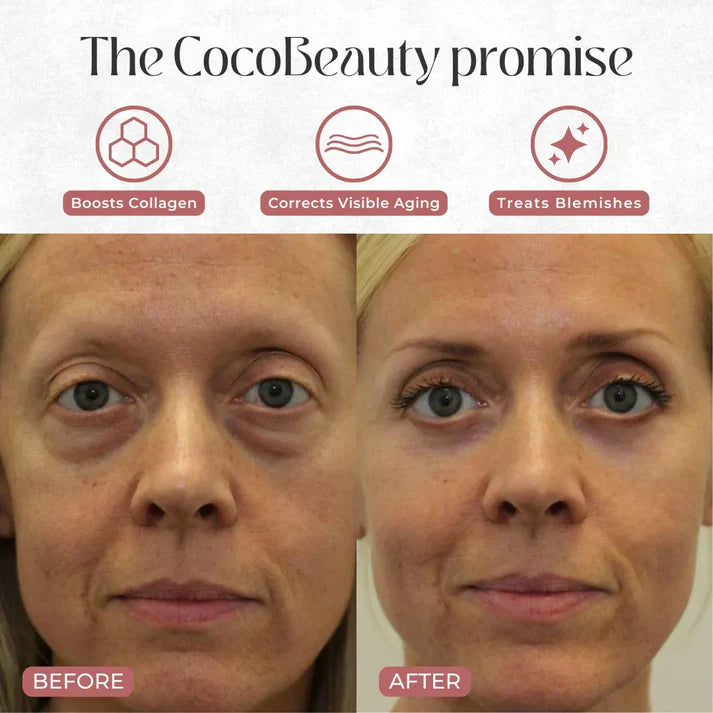 Light Eye Massage Creamwith Caffeine & Hyaluronic Acid for Dark Circles Firming Fine Lines Hydrating Moisturizing Radiant Skin Care with Red Light Micro-Vibration Head