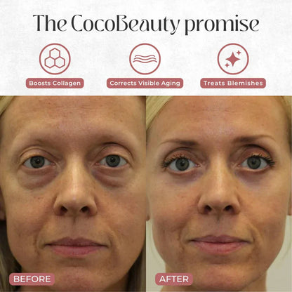 Light Eye Massage Creamwith Caffeine & Hyaluronic Acid for Dark Circles Firming Fine Lines Hydrating Moisturizing Radiant Skin Care with Red Light Micro-Vibration Head