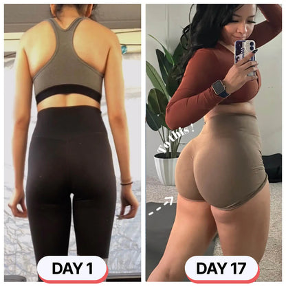 PeachPulse™ Pro - The No.1 EMS device for sculpting, firming, and weight loss