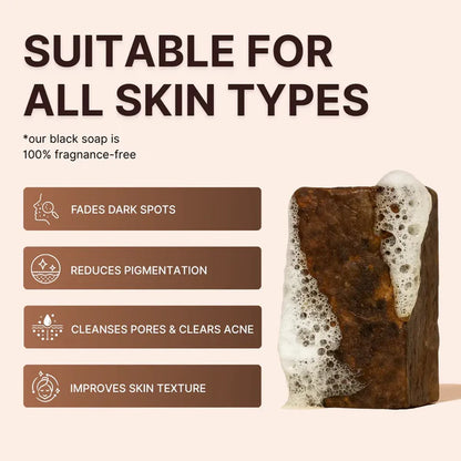 EarthGlow Anti-Acne & Dark Spots African Soap