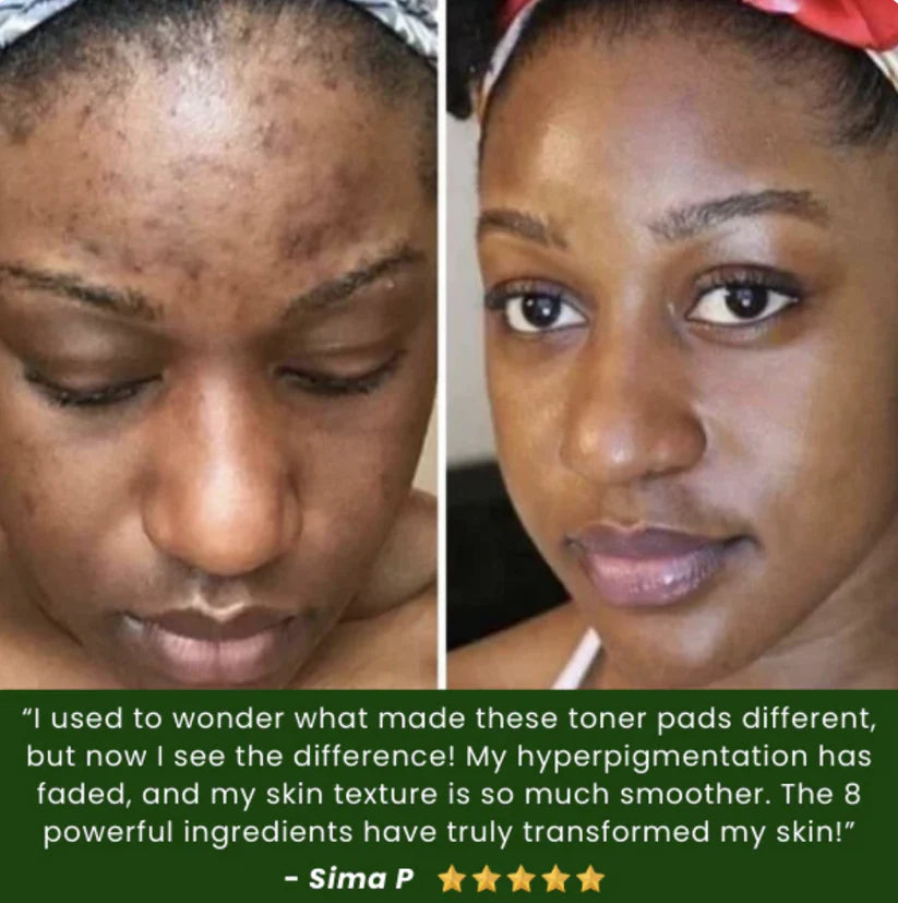JIYU Toner Pads – Dermatologist-Tested, K-Beauty Inspired